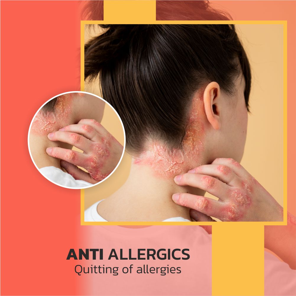 Anti-allergics